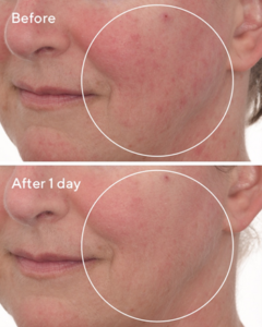 Murad skin care Bowen QLD, Murad skin care Bundaberg QLD, Murad skin care Melbourne, Murad skin care Your Beauty routine, Murad skin care Warragul Vic, , Murad skin care Traralgon Gippsland Vic, Murad skin care Pakenham Vic, Murad skin care Bunyip Vic, Murad skin care Druin Vic, Murad skin care Longwarry Vic, Murad skin care Online Australia